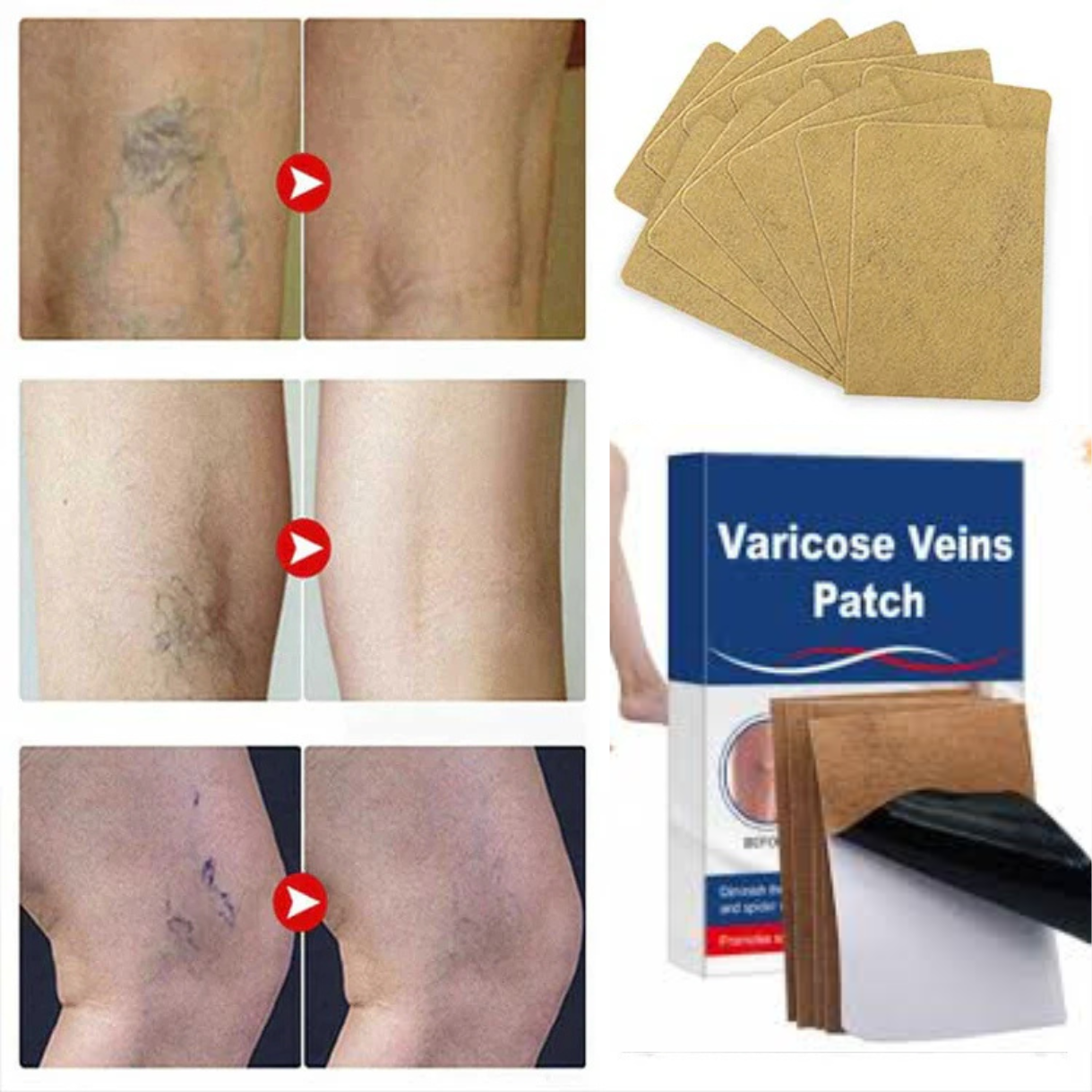 Parche Para Venas Y Varices 2X1 x10pz Por Paquete