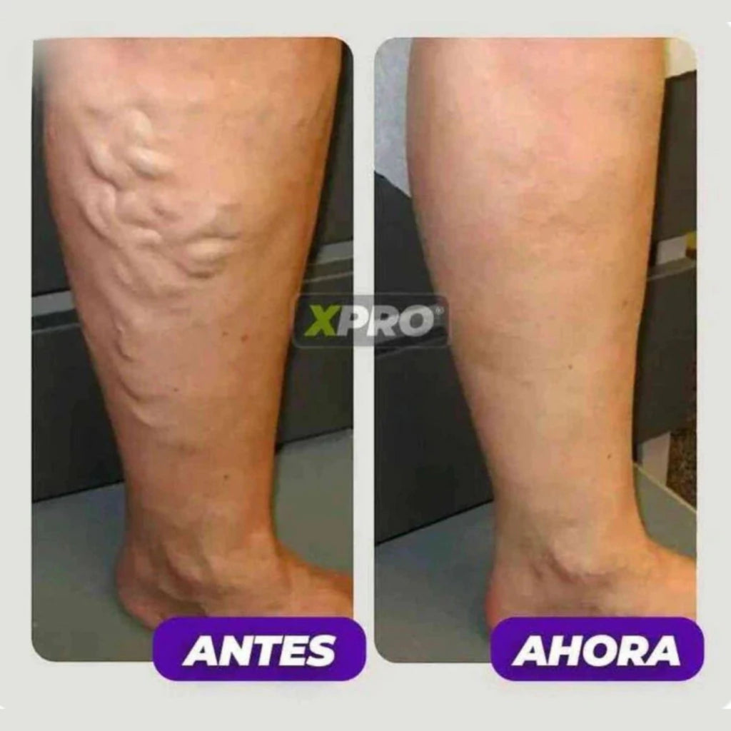 Rodillera térmica - 30% OFF